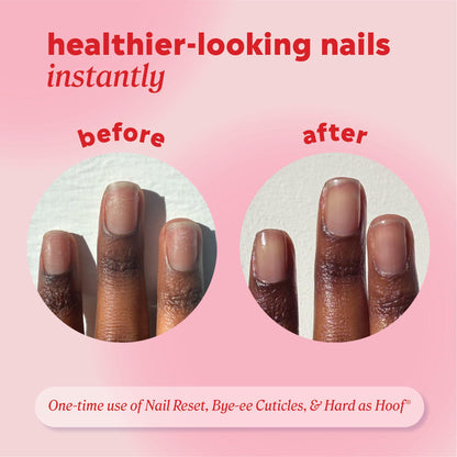 Onyx Professional Hard as Hoof Nail Strengthening Cream, Island Coconut Scent - Nail Growth and Conditioning Cuticle Cream Stops Splits, Chips