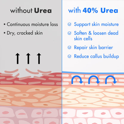 Ebanel Urea Cream 40% plus Salicylic Acid 2%, Foot Cream for Dry Cracked Heels Feet Knees Elbows Hands, Foot Dead Skin Cuticle Callus Remover Toenail Softener, Keratolytic Skin Barrier Repair, 2-Pack