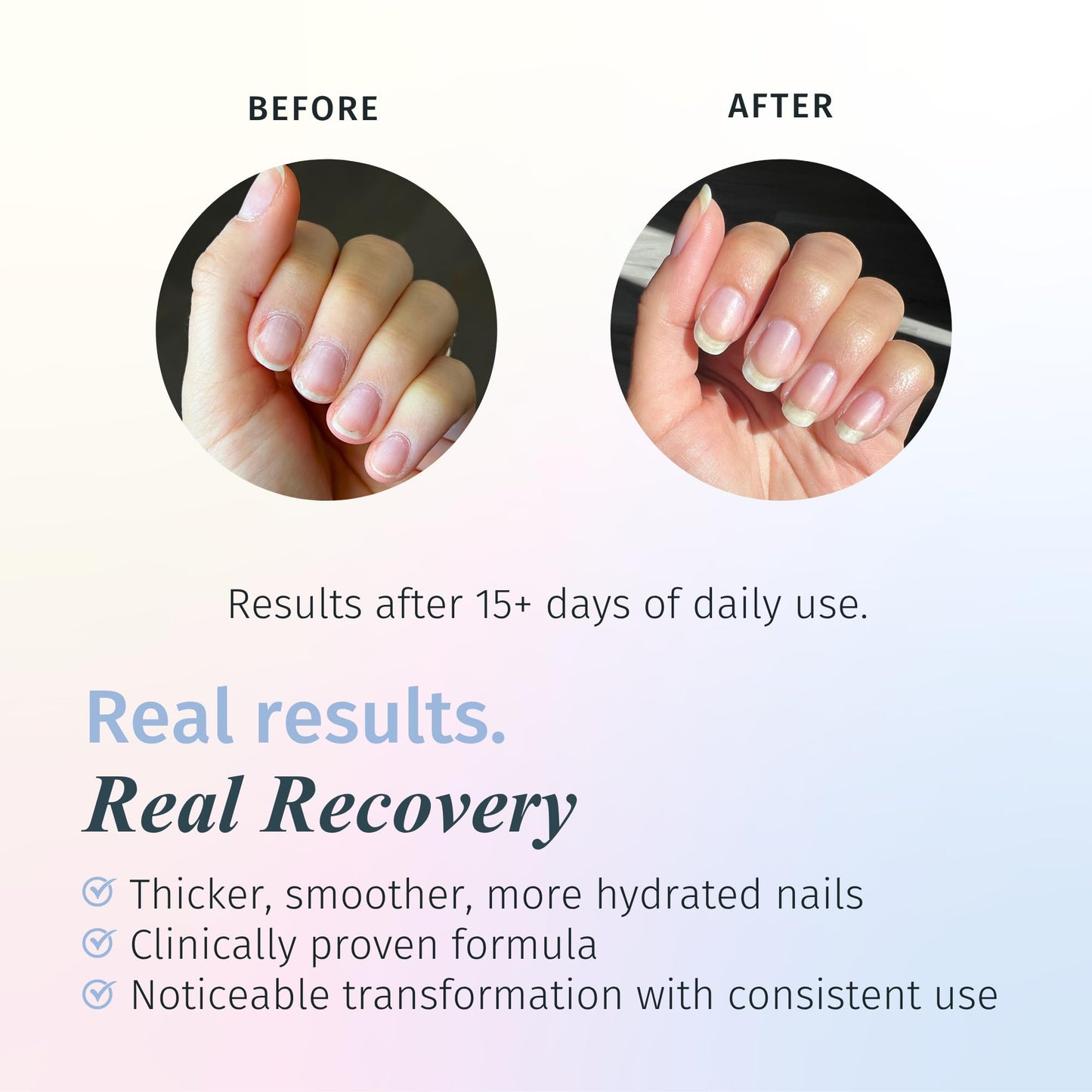 duri Rejuvacote 1 Nail Strengthener, Maximum Effect Formula, For brittle, weak, or post-damage nails (Pack of 3-0.45 fl. oz. each)