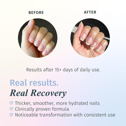 duri Rejuvacote 1 Nail Strengthener, Maximum Effect Formula, For brittle, weak, or post-damage nails (Pack of 3-0.45 fl. oz. each)