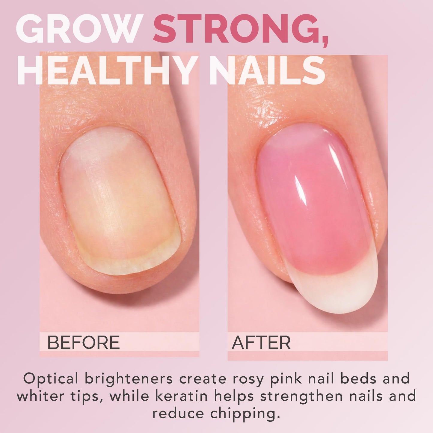 Perfect Formula Pink Gel Coat – Rosey Glow Nail Strengthener & Keratin Treatment, 0.6 oz - Protein-Rich, Glossy Pink