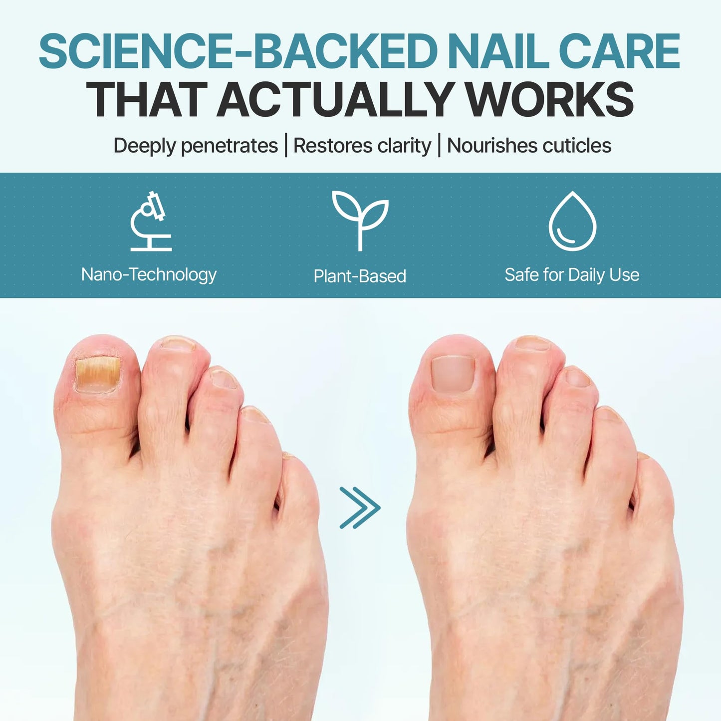 Nail Therapy Triple Clear HF Nano Nail Strengthener Oil for Damaged & Nails affected by moisture and wear– Plant-Based Toenail & Fingernail Oil for Thick