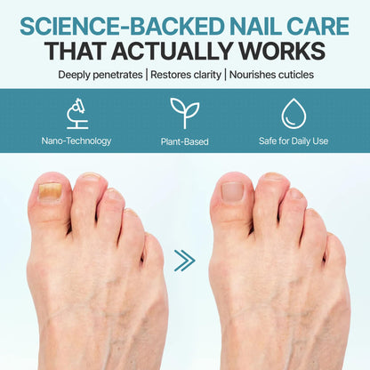 Nail Therapy Triple Clear HF Nano Nail Strengthener Oil for Damaged & Nails affected by moisture and wear– Plant-Based Toenail & Fingernail Oil for Thick