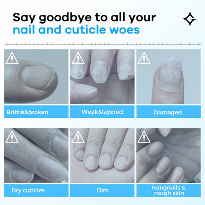 Glamonade Hard Nail Strengthening Cream: Nail strengthener and Cuticle Treatment To Repair Damaged Thin Nails and Dry Cracked Skin&Grow Nails,