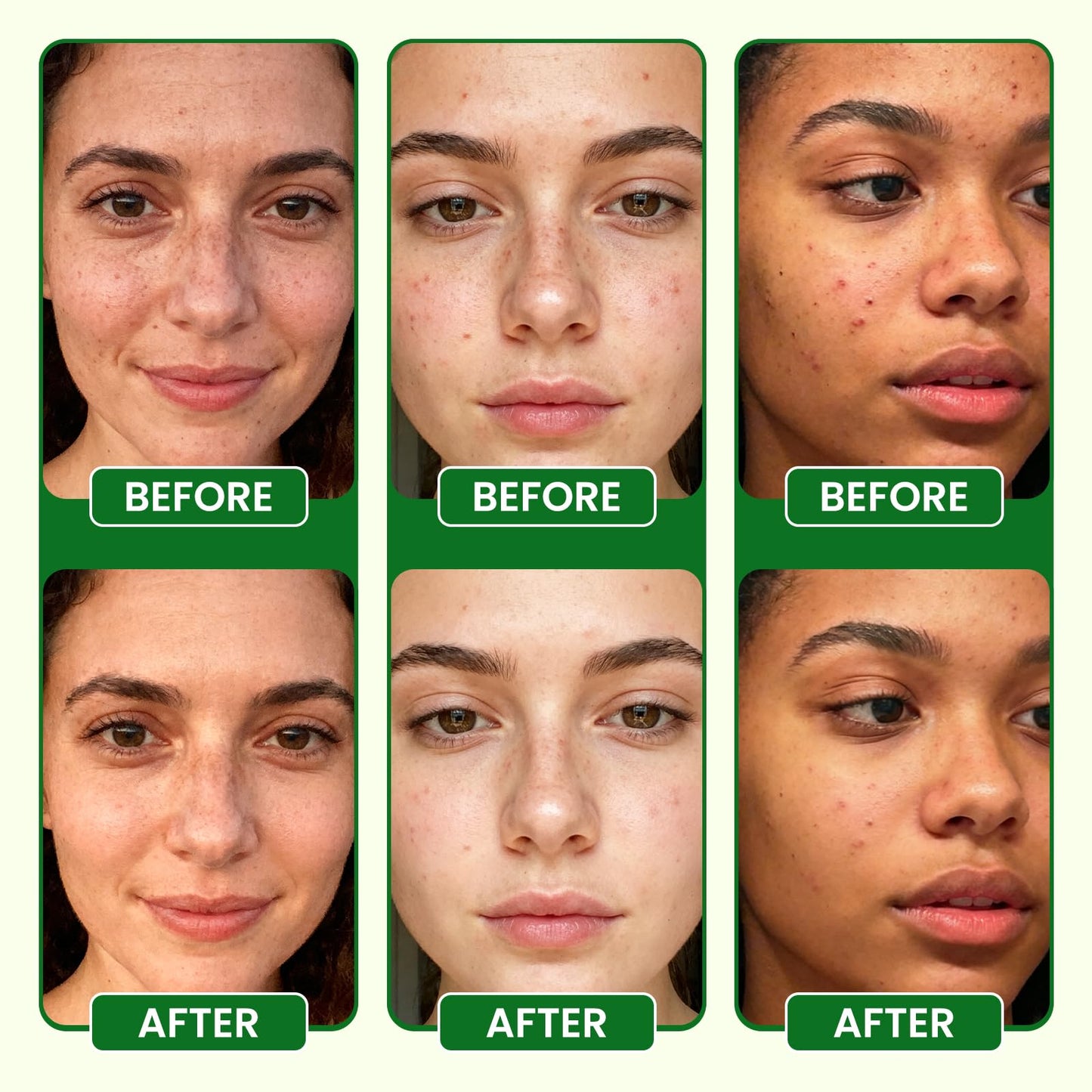 Lukaree Vitamin C Serum for Face, Dark Spots, Fine Lines & Support Collagen | Vitamin C Serum 20% Brightening Face Serum with Sodium Hyaluronate - All Skin Types, Plus Vit C Caps, 1 Fl Oz + 60 Caps