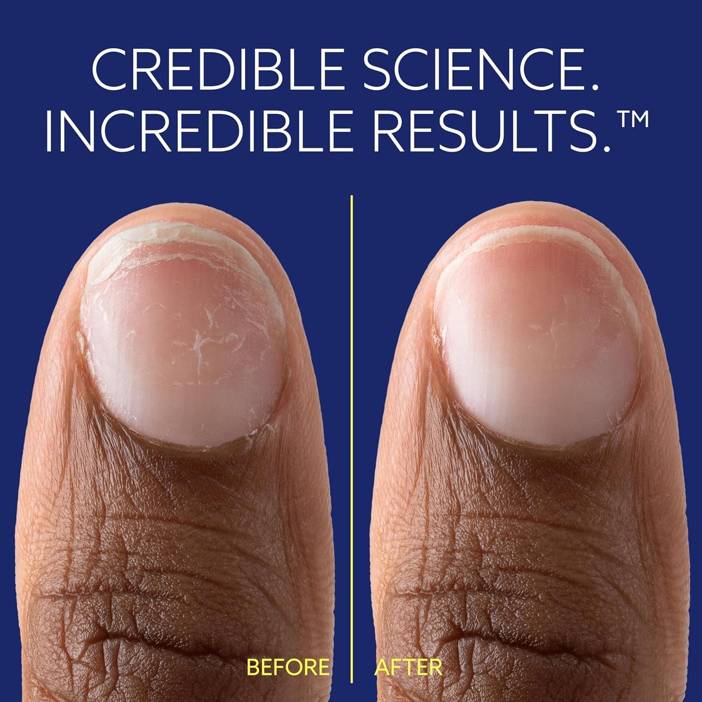 ePhD Bond Repair Nail Treatment, Nail Repair that Strengthens, Restores & Rebuilds Brittle Nails, Strengthens from Within, Formula for Damaged