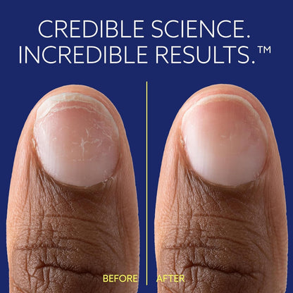 ePhD Bond Repair Nail Treatment, Nail Repair that Strengthens, Restores & Rebuilds Brittle Nails, Strengthens from Within, Formula for Damaged