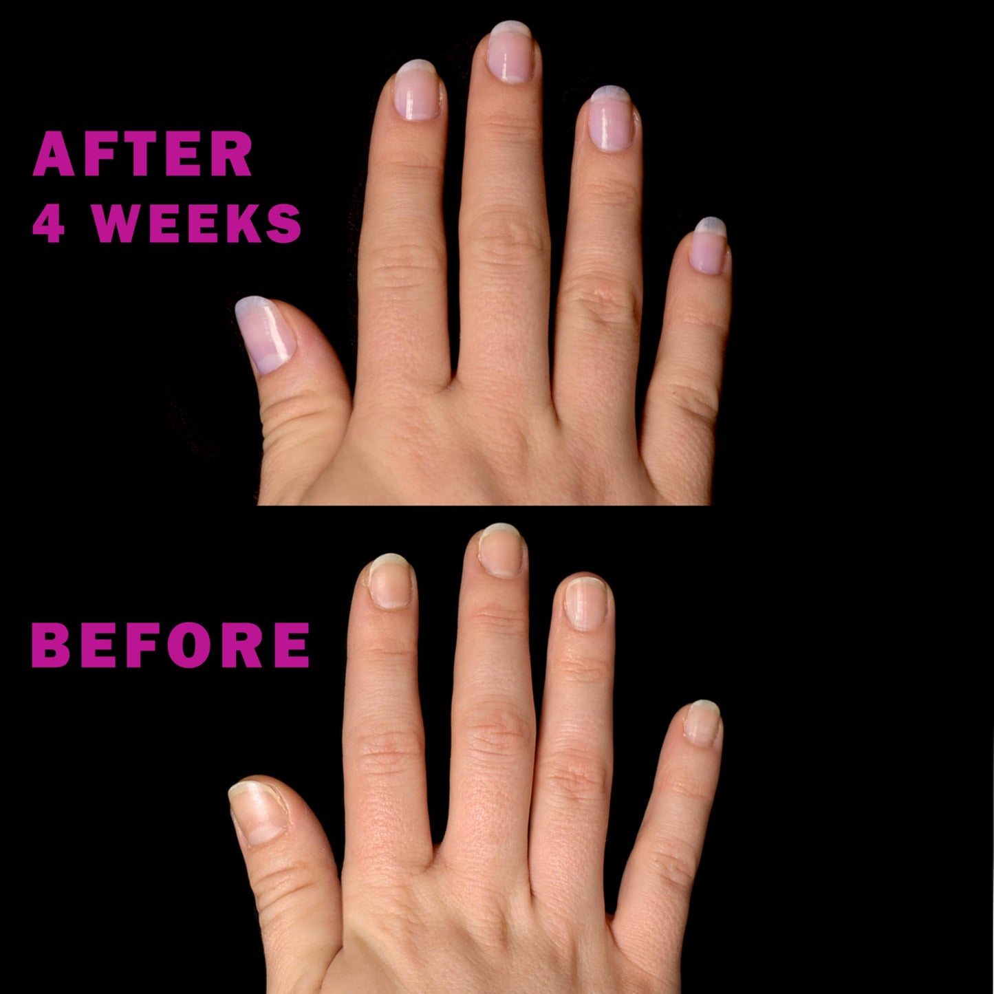 Perfect Formula Nail Essentials Kit – 4-Piece Keratin Nail Strengthener and Growth - Nail Repair For Damaged Nails | High Gloss Finish