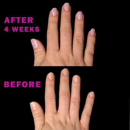 Perfect Formula Nail Essentials Kit – 4-Piece Keratin Nail Strengthener and Growth - Nail Repair For Damaged Nails | High Gloss Finish