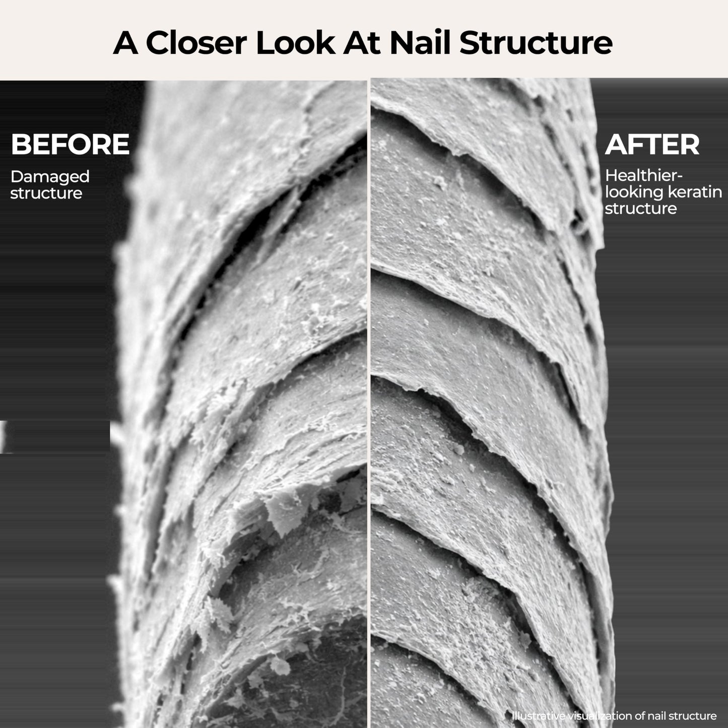 Fast Absorbing Nail Strengthening Serum for Damaged, Brittle & Thin Nails — Post-Acrylic & Gel Damage Treatment with Keratin, Peptides, Hyaluronic Acid & Niacinamide — 45-Day Supply by nakeyNails