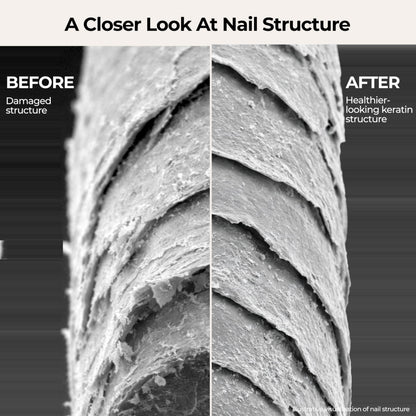 Fast Absorbing Nail Strengthening Serum for Damaged, Brittle & Thin Nails — Post-Acrylic & Gel Damage Treatment with Keratin, Peptides, Hyaluronic Acid & Niacinamide — 45-Day Supply by nakeyNails