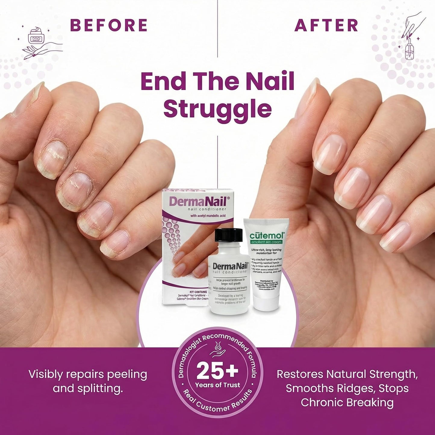 DermaNail Nail Strengthener & Cuticle Cream Set - Fingernail Care Kit with Liquid Nail Strengthener & Cutemol Cream (11.5g Sample) Healthy Growth