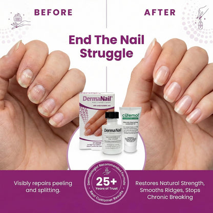 DermaNail Nail Strengthener & Cuticle Cream Set - Fingernail Care Kit with Liquid Nail Strengthener & Cutemol Cream (11.5g Sample) Healthy Growth