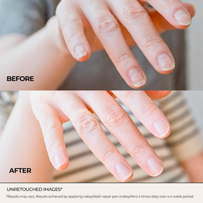 Fast Absorbing Nail Strengthening Serum for Damaged, Brittle & Thin Nails — Post-Acrylic & Gel Damage Treatment with Keratin, Peptides, Hyaluronic Acid & Niacinamide — 45-Day Supply by nakeyNails