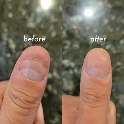 Strong Growth Nail Strengthener for Nail Biting, 5.9ml, Made in USA